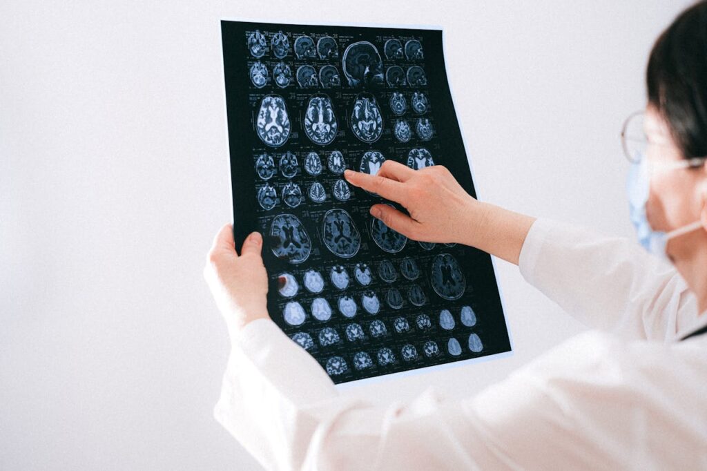 Brain Injuries in Car Accidents